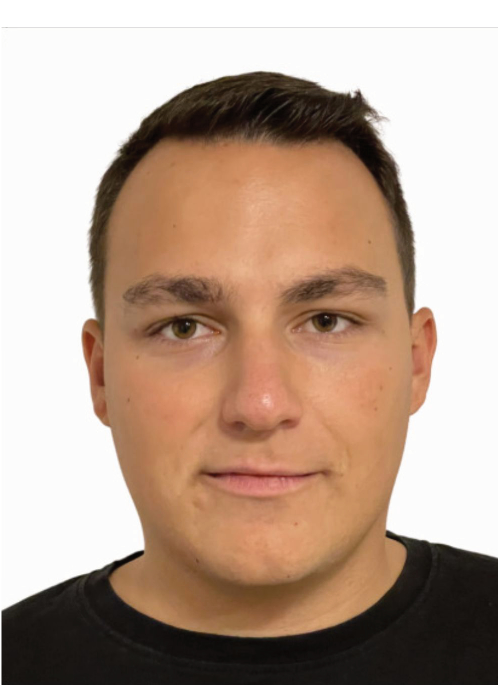 Fabian Burtscher